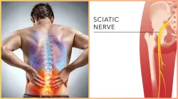 What is sciatica - India TV Hindi