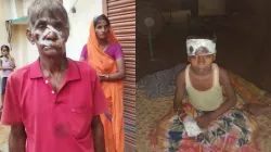 Wolf Attack Victim- India TV Hindi