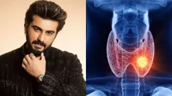 Arjun Kapoor is suffering from Hashimoto- India TV Hindi