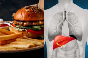 खाने की ऐसी चीजें, जो बन सकती हैं फैटी लिवर का कारण, कहीं आप भी तो नहीं कर रहे हैं सेवन?