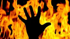 तेलंगाना : महिला तहसीलदार के बाद अब उन्‍हें बचाने की कोशिश करने वाले ड्राइवर की भी जलने से मौत 