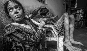 bhopal gas victim- India TV Hindi
