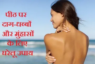 acne- India TV Hindi