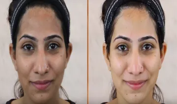 Glowing skin- India TV Hindi