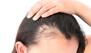 Hair Loss- India TV Hindi