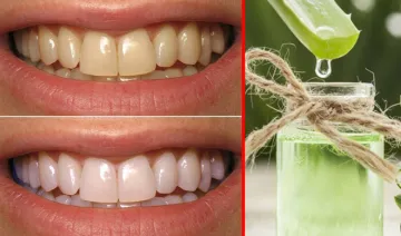 aloe vera use for white teeth- India TV Hindi