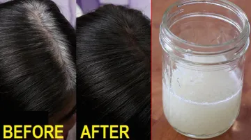 white hair home remedy- India TV Hindi