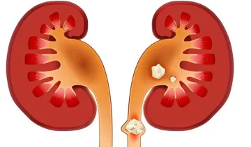 kidney- India TV Hindi