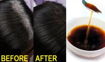 <p>hair care</p>- India TV Hindi