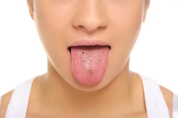 <p>black spots on your tongue</p>- India TV Hindi