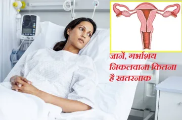 uterus removal surgery- India TV Hindi