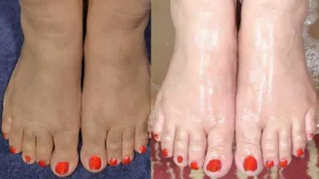 Tanning Free foot- India TV Hindi