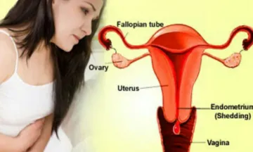 Cervical Cancer- India TV Hindi