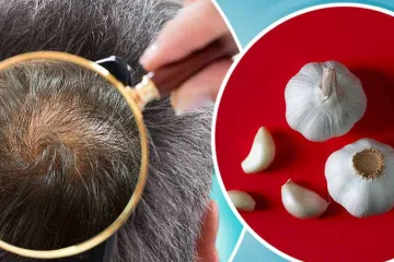 Garlic for hair growth - India TV Hindi