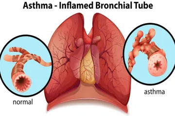 World Asthma day- India TV Hindi