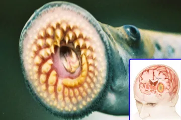 Jawless fish sea lamprey may help to treat brain tumor - India TV Hindi