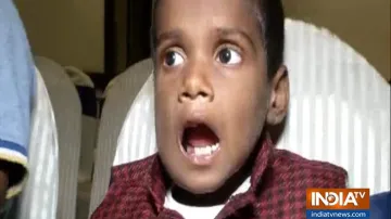 चेन्नई में दुनिया का सबसे अनोखा ऑपेरशन, 7 साल के बच्चे के मुंह से निकाले 526 दांत- India TV Hindi