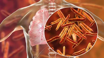 quarter of the worlds population at risk of developing tuberculosis- India TV Hindi