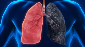 <p>lungs cancer</p>- India TV Hindi