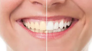 <p>healthy teeth</p>- India TV Hindi