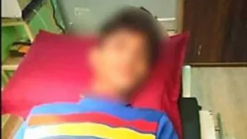 Jilted lover attacks boy, Girl disfigures boy face with blade- India TV Hindi