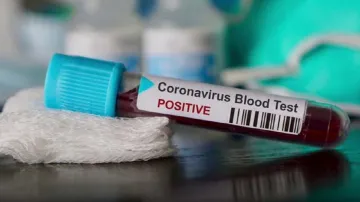 <p>coronavirus lockdown live updates covid 19 latest...- India TV Hindi