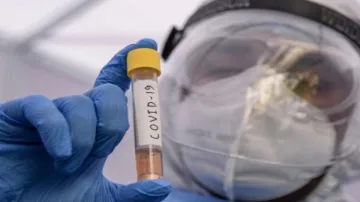 Novel coronavirus may resemble common cold in future, scientists predict- India TV Hindi