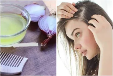 Onion juice and hair fall- India TV Hindi