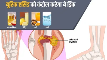 Uric Acid Water Apple Vinegar Haldi Lemon Drink Control Instantly Uric Acid Problem Naturally- यूरिक- India TV Hindi