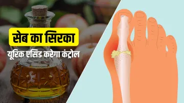 <p>Apple Vinegar control Uric Acid</p>- India TV Hindi
