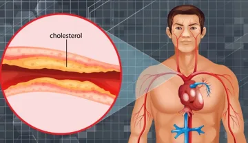 Homemade juice for Cholesterol- India TV Hindi