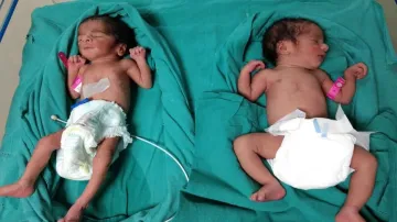  Twin babies- India TV Hindi