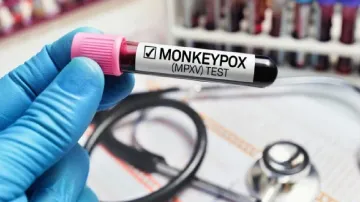 Monkeypox Testing Kit- India TV Hindi