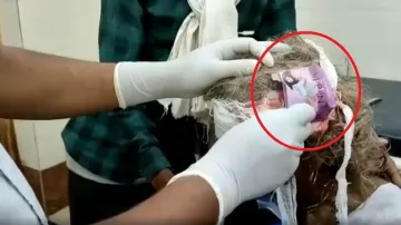 Condom's empty packet tied with a bandage on woman's wound- India TV Hindi