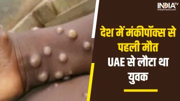 First death due to monkeypox in the country- India TV Hindi