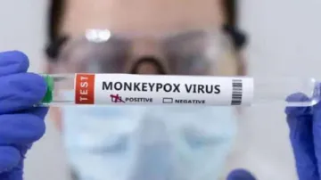 Monkeypox Cases in Delhi- India TV Hindi
