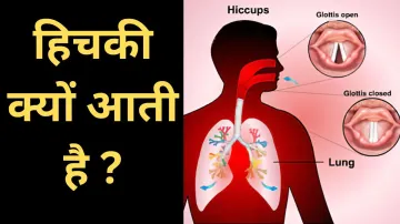 What if Hiccups- India TV Hindi