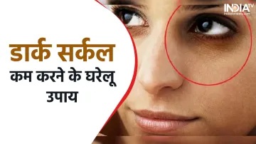 Dark Circle Removal Tips- India TV Hindi