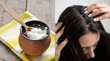 curd_for_hair- India TV Hindi