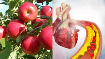  Apple in high cholesterol- India TV Hindi