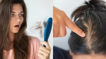 zinc and hair loss- India TV Hindi