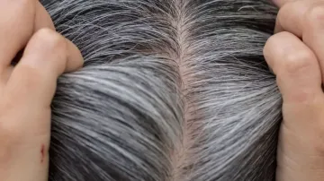 grey_hair_remedies- India TV Hindi