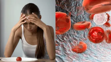 anemia- India TV Hindi