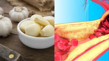 High cholesterol remedy- India TV Hindi