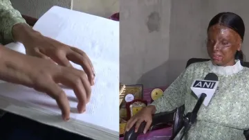 acid attack survivor kafi- India TV Hindi