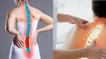 spondylitis- India TV Hindi