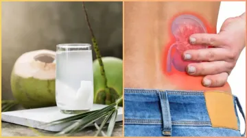 Coconut water for kidney stones- India TV Hindi