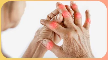 Foods to Avoid in Arthritis - India TV Hindi