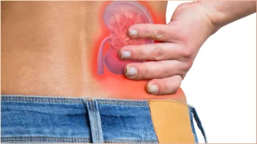 first symptom of a kidney stone- India TV Hindi