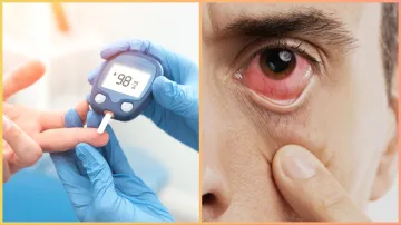 Eye diseases in diabetes- India TV Hindi